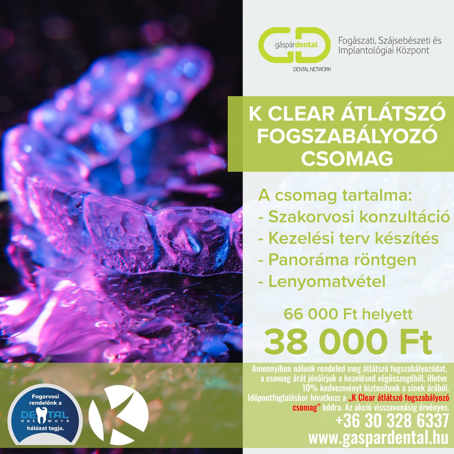 K Clear fogszabályozó csomag
